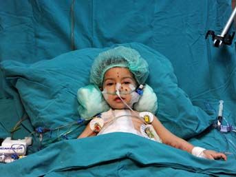 2 yaşındaki &ccedil;ocuğa kalp nakli 1