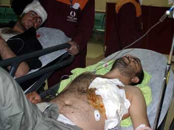 Adıyaman da 5 aile kavga etti: 2 ölü, 6 yaralı 1