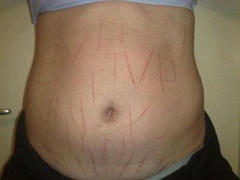 Avrupa nın ortasında vahşet 1