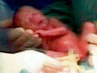 Altızlar d&uuml;nyaya b&ouml;yle geldi 1