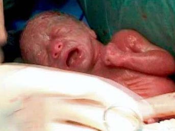 Altızlar d&uuml;nyaya b&ouml;yle geldi 2