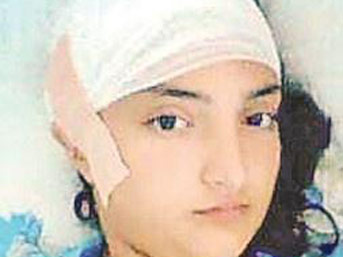 beyin kanama
