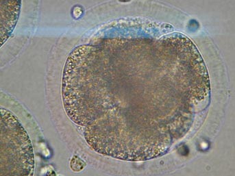 10 yaşında &ouml;ld&uuml;, yeniden doğacak 2