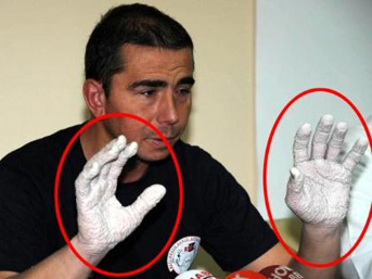 cem
