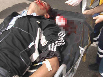 &Ccedil;ılgın koca dehşet sa&ccedil;tı 2