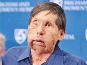 Eşinin y&uuml;z&uuml;yle arkadaş oldu 2