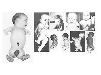 Nazilerin son savaş su&ccedil;u 1