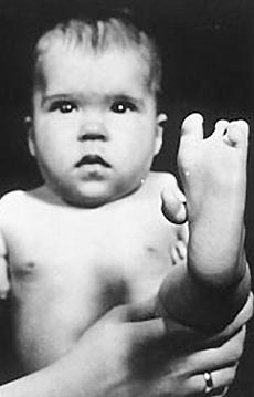 Nazilerin son savaş su&ccedil;u 3