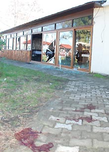 Doktorun elinden alıp şarjörü boşalttı 4