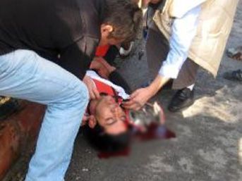 Bisiklet yarışında talihsiz kaza 2